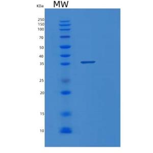 Recombinant Human PPA1 Protein,Recombinant Human PPA1 Protein