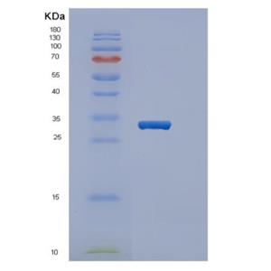 Recombinant Human PPARG Protein