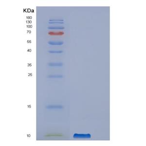 Recombinant Human PPBP Protein,Recombinant Human PPBP Protein