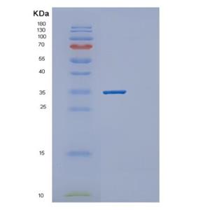 Recombinant Human PPCS Protein,Recombinant Human PPCS Protein