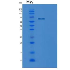 Recombinant Human PPIL2 Protein,Recombinant Human PPIL2 Protein