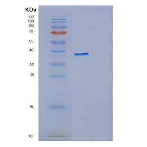 Recombinant Human PPP1R8 Protein