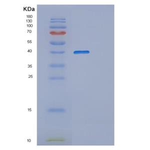 Recombinant Human PPP1SS Protein,Recombinant Human PPP1SS Protein