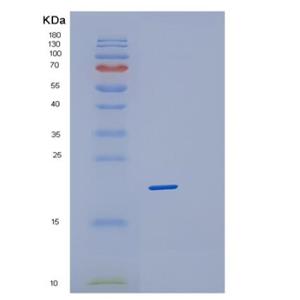 Recombinant Human PPP3R1 Protein,Recombinant Human PPP3R1 Protein