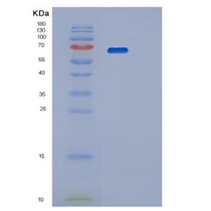 Recombinant Human PPP2R1A Protein,Recombinant Human PPP2R1A Protein