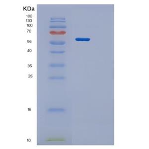 Recombinant Human PPP3CA Protein