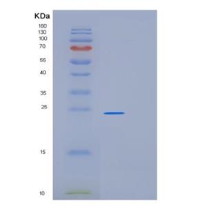 Recombinant Human PRDX1 Protein