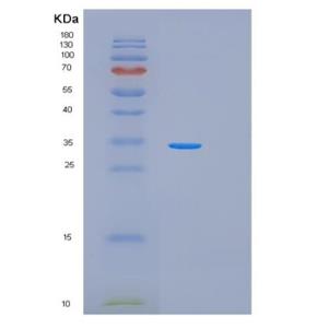 Recombinant Human PRKAA1 Protein,Recombinant Human PRKAA1 Protein