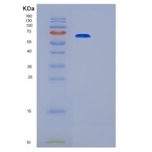 Recombinant Human PRKACA Protein,Recombinant Human PRKACA Protein