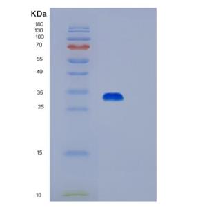 Recombinant Human PRKAB2 Protein,Recombinant Human PRKAB2 Protein