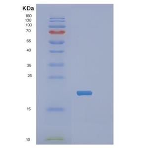 Recombinant Human PPP1R14A Protein,Recombinant Human PPP1R14A Protein