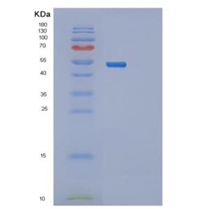 Recombinant Human PRKAR2A Protein