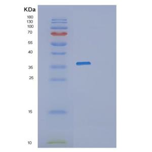 Recombinant Human PRKRA Protein