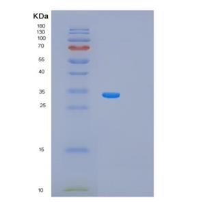 Recombinant Human PRKAB1 Protein,Recombinant Human PRKAB1 Protein