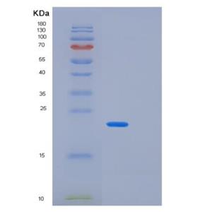Recombinant Human PPP3R2 Protein,Recombinant Human PPP3R2 Protein