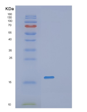 Recombinant Human PRND Protein,Recombinant Human PRND Protein