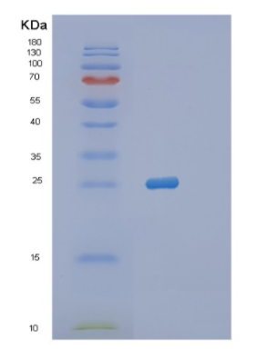 Recombinant Human PRNP Protein,Recombinant Human PRNP Protein