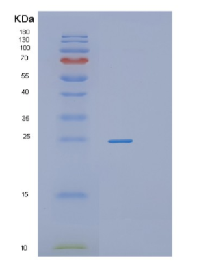 Recombinant Human PROCR Protein,Recombinant Human PROCR Protein