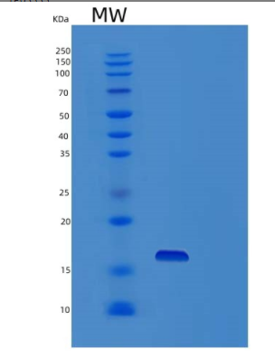 Recombinant Human Profilin-4 Protein,Recombinant Human Profilin-4 Protein