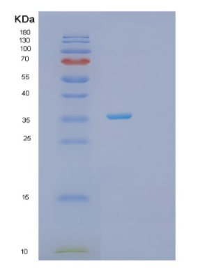 Recombinant Human PRPS2 Protein,Recombinant Human PRPS2 Protein