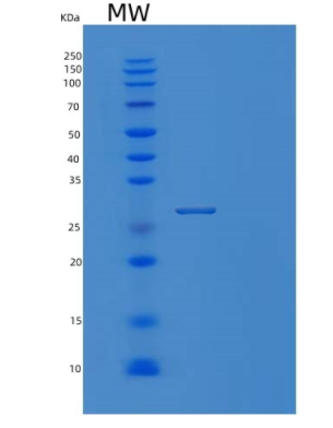 Recombinant Human PRTFDC1 Protein,Recombinant Human PRTFDC1 Protein