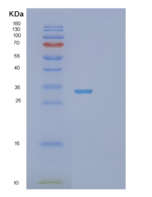 Recombinant Human PSMA1 Protein,Recombinant Human PSMA1 Protein