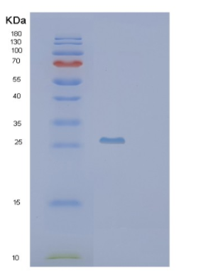 Recombinant Human PSMB10 Protein,Recombinant Human PSMB10 Protein