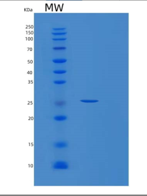 Recombinant Human PSMB5 Protein,Recombinant Human PSMB5 Protein