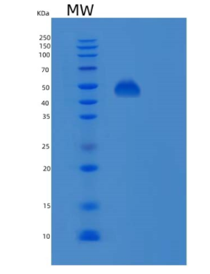 Recombinant Human PSMD11 Protein,Recombinant Human PSMD11 Protein