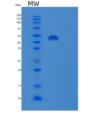 Recombinant Human PSMD13 Protein,Recombinant Human PSMD13 Protein