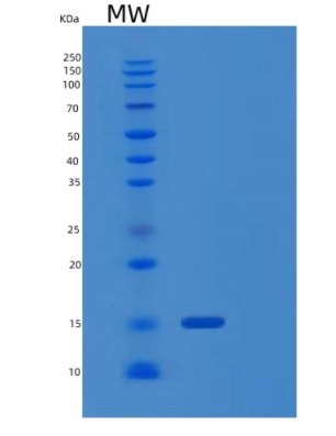 Recombinant Human PSMG4 Protein,Recombinant Human PSMG4 Protein