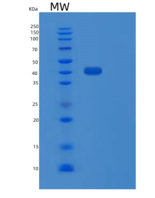 Recombinant Human PTPN7 Protein,Recombinant Human PTPN7 Protein