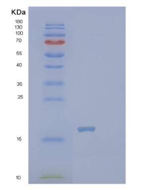 Recombinant Human PTRHD1 Protein,Recombinant Human PTRHD1 Protein