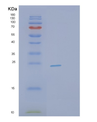 Recombinant Human PTTG1 Protein,Recombinant Human PTTG1 Protein