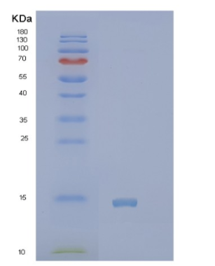 Recombinant Human PVALB Protein,Recombinant Human PVALB Protein