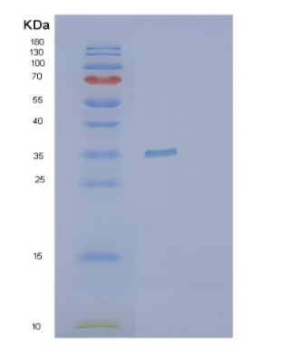 Recombinant Human PYCR1 Protein,Recombinant Human PYCR1 Protein