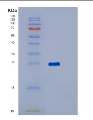 Recombinant Human RAB1B Protein,Recombinant Human RAB1B Protein