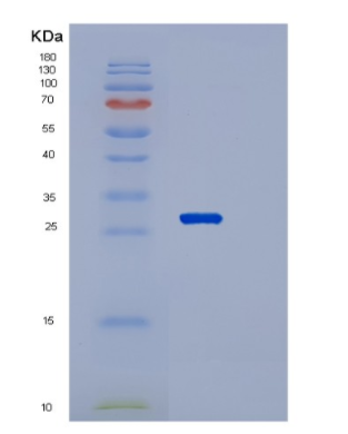 Recombinant Human RAB21 Protein,Recombinant Human RAB21 Protein