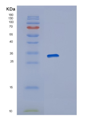 Recombinant Human RAB23 Protein,Recombinant Human RAB23 Protein