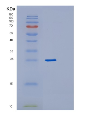 Recombinant Human RAB24 Protein,Recombinant Human RAB24 Protein