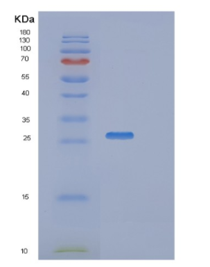 Recombinant Human RAB27B Protein,Recombinant Human RAB27B Protein