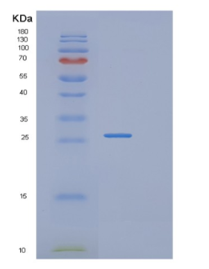 Recombinant Human RAB2B Protein,Recombinant Human RAB2B Protein