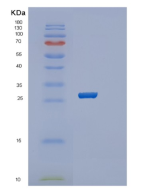 Recombinant Human RAB39B Protein,Recombinant Human RAB39B Protein