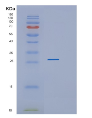 Recombinant Human RAB3B Protein,Recombinant Human RAB3B Protein