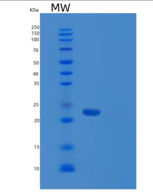 Recombinant Human RAP1B Protein,Recombinant Human RAP1B Protein