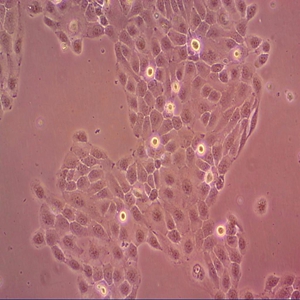 D341 Med人髓母细胞瘤细胞,D341 Med