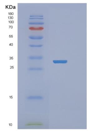 Recombinant Human RASD2 Protein,Recombinant Human RASD2 Protein