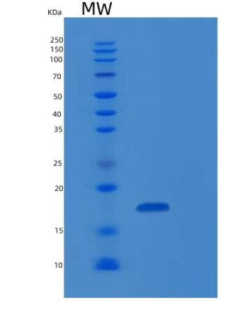 Recombinant Human RARRES2 Protein,Recombinant Human RARRES2 Protein