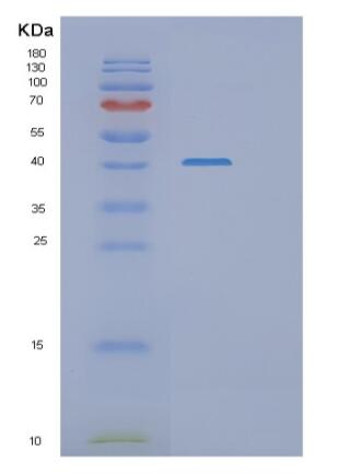 Recombinant Human RASSF1A Protein,Recombinant Human RASSF1A Protein