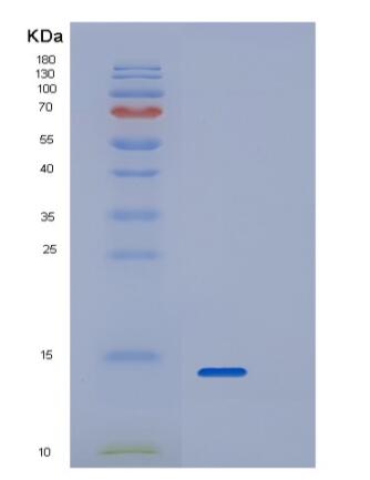 Recombinant Human RPAIN Protein,Recombinant Human RPAIN Protein